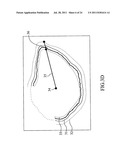 QUANTIFICATION METHOD OF THE FEATURE OF A TUMOR AND AN IMAGING METHOD OF     THE SAME diagram and image