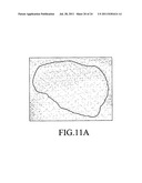 QUANTIFICATION METHOD OF THE FEATURE OF A TUMOR AND AN IMAGING METHOD OF     THE SAME diagram and image