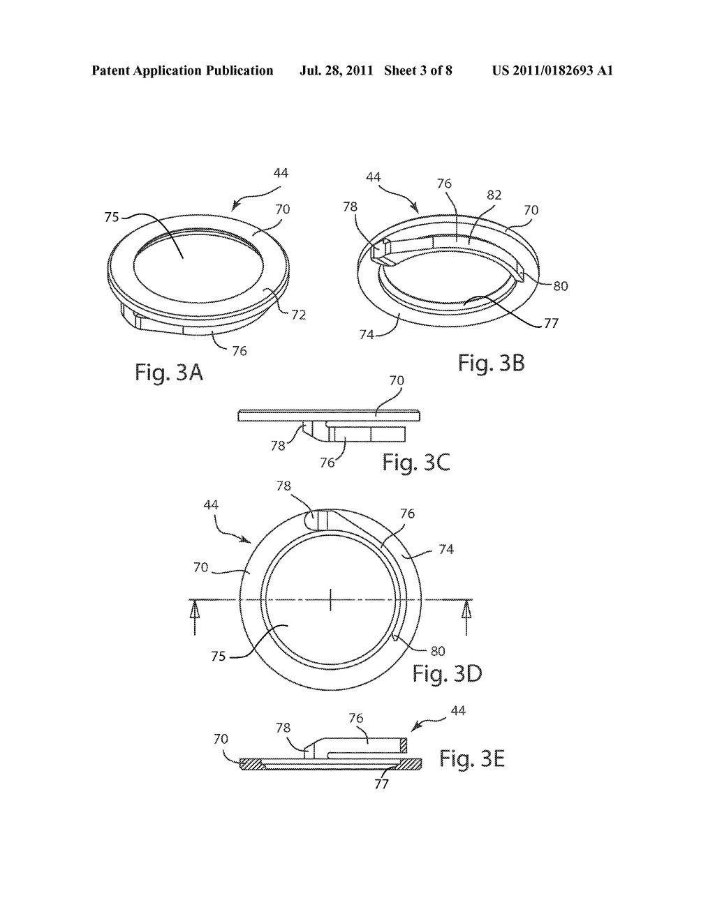 POLYAXIAL FACET FIXATION SCREW SYSTEM - diagram, schematic, and image 04