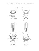 POLYAXIAL FACET FIXATION SCREW SYSTEM diagram and image