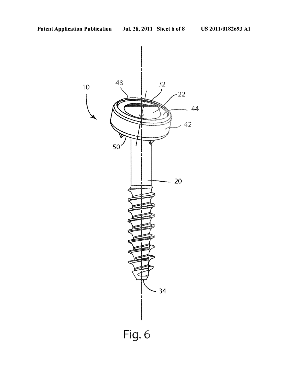 POLYAXIAL FACET FIXATION SCREW SYSTEM - diagram, schematic, and image 07