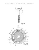 POLYAXIAL FACET FIXATION SCREW SYSTEM diagram and image