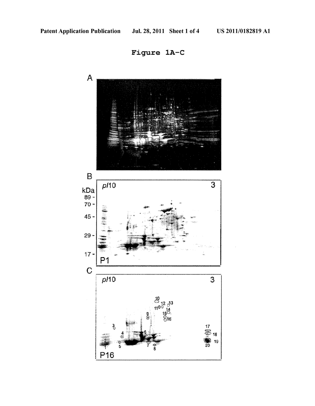 Methods and Compounds for Promoting Vessel Regression - diagram, schematic, and image 02