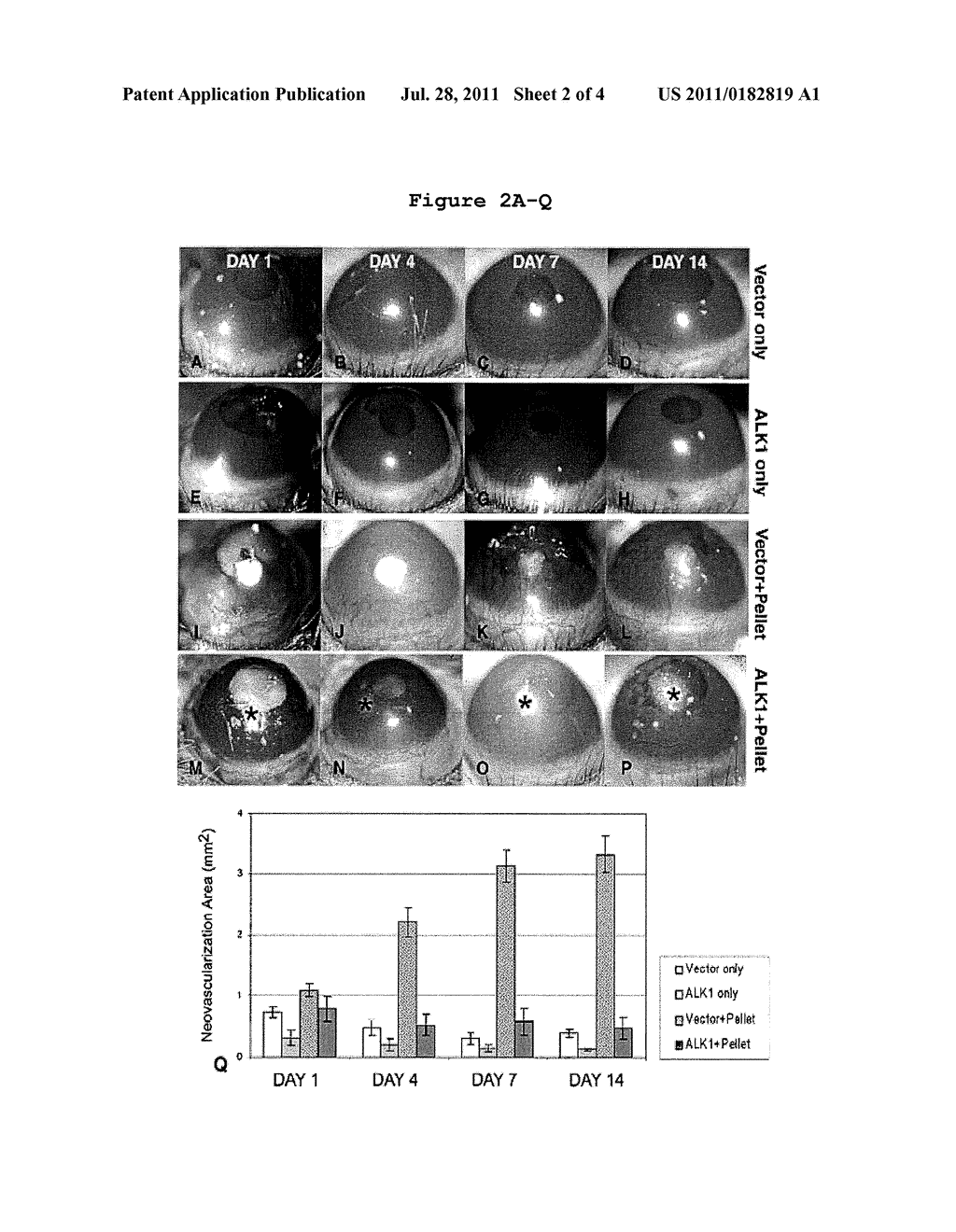 Methods and Compounds for Promoting Vessel Regression - diagram, schematic, and image 03