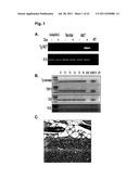 SIGNATURE AND DETERMINANTS ASSOCIATED WITH METASTASIS AND METHODS OF USE     THEREOF diagram and image