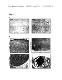 SIGNATURE AND DETERMINANTS ASSOCIATED WITH METASTASIS AND METHODS OF USE     THEREOF diagram and image