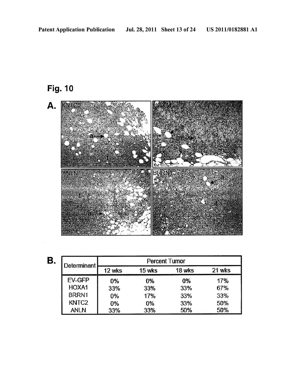 SIGNATURE AND DETERMINANTS ASSOCIATED WITH METASTASIS AND METHODS OF USE     THEREOF - diagram, schematic, and image 14