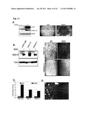 SIGNATURE AND DETERMINANTS ASSOCIATED WITH METASTASIS AND METHODS OF USE     THEREOF diagram and image