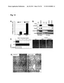 SIGNATURE AND DETERMINANTS ASSOCIATED WITH METASTASIS AND METHODS OF USE     THEREOF diagram and image