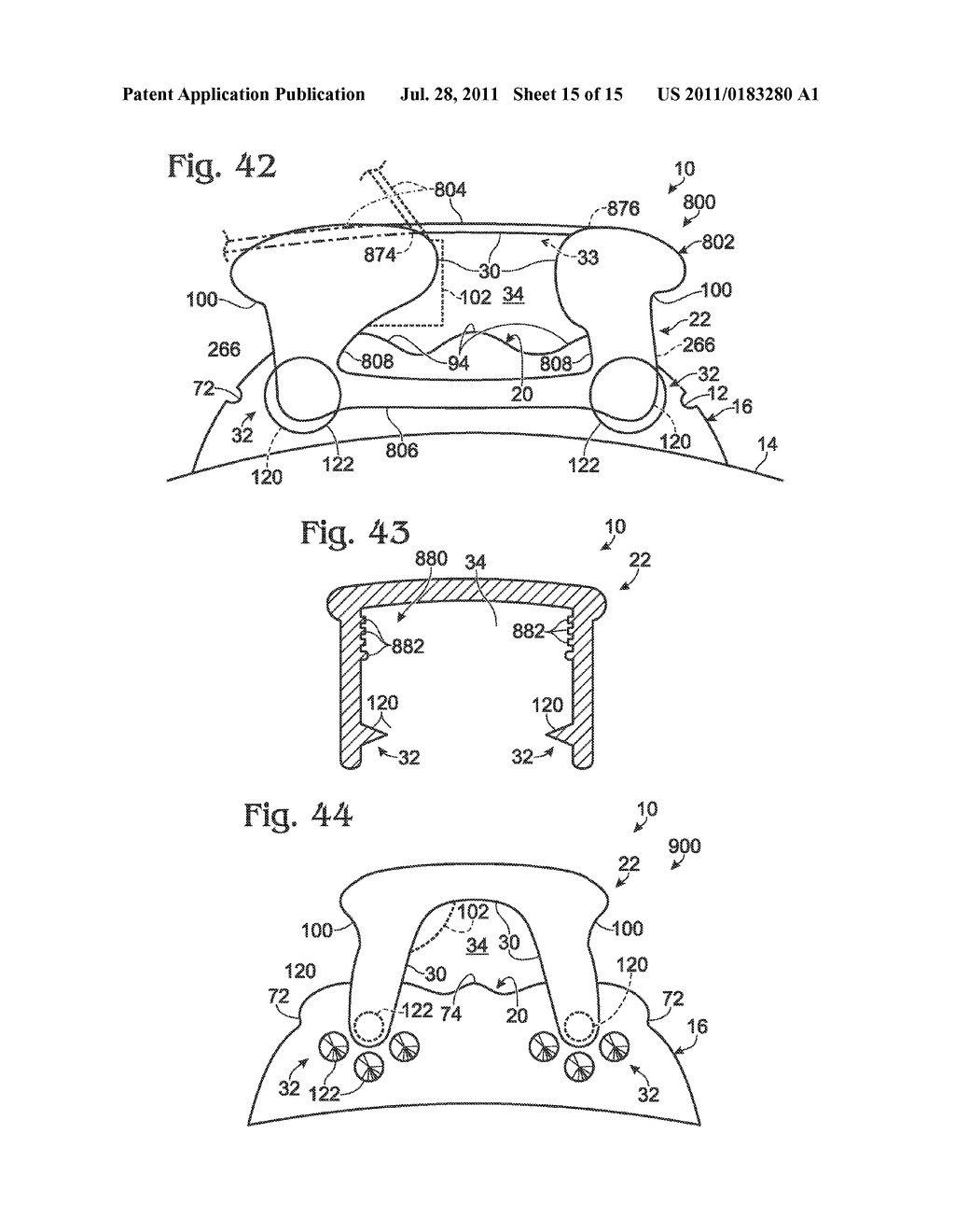 ORTHODONTIC APPLIANCE SYSTEMS - diagram, schematic, and image 16