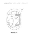 TONGUE RETRACTOR AND FLUID/PARTICLE BARRIER diagram and image