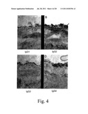 METHOD TO IDENTIFY PATIENTS AT RISK FOR LUNG TRANSPLANT REJECTION diagram and image