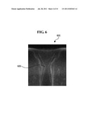 CONTACT PATTERNING METHOD WITH TRANSITION ETCH FEEDBACK diagram and image