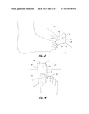 METHOD AND APPARATUS FOR TREATING PLANTAR FASCIITIS diagram and image