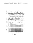 METHOD OF TREATING ATRIAL FIBRILLATION diagram and image