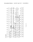 METHOD OF TREATING ATRIAL FIBRILLATION diagram and image