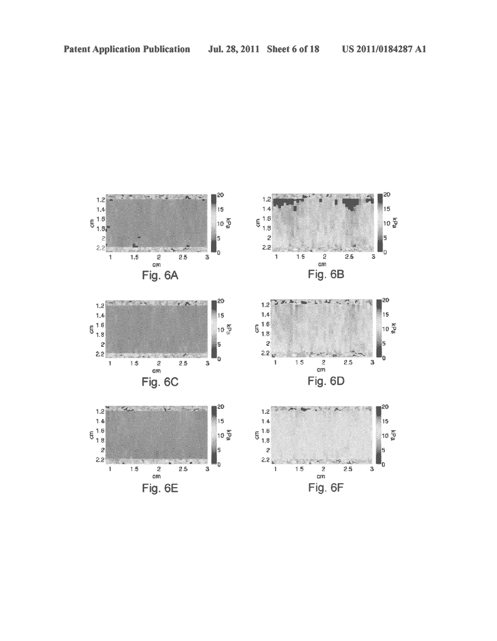 Methods And Systems For Spatially Modulated Ultrasound Radiation Force     Imaging - diagram, schematic, and image 07