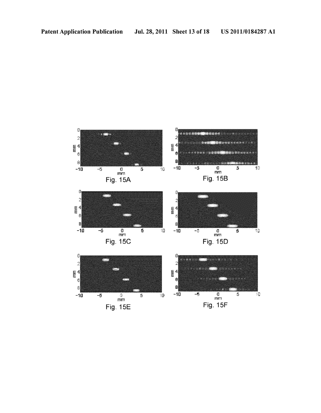 Methods And Systems For Spatially Modulated Ultrasound Radiation Force     Imaging - diagram, schematic, and image 14