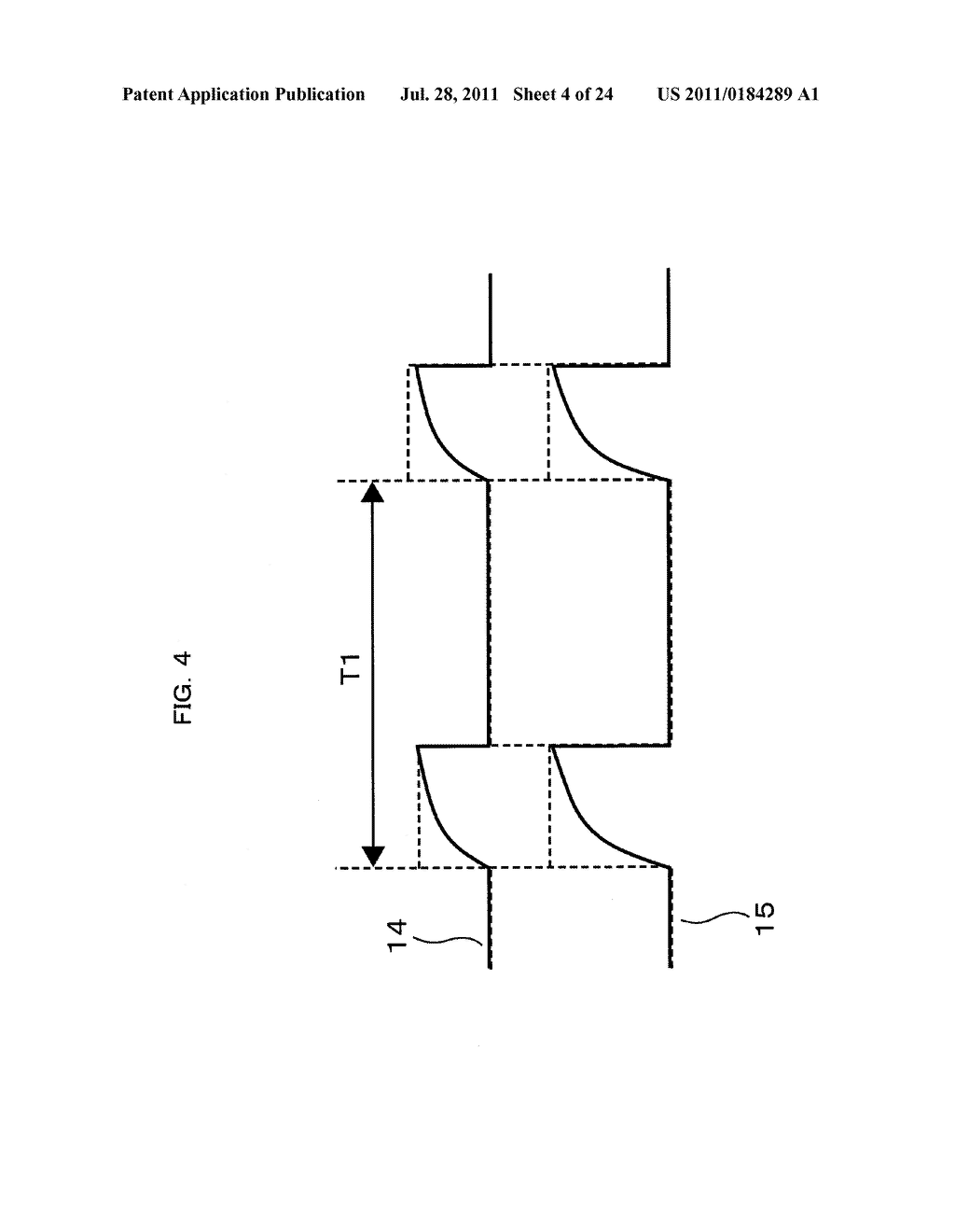 ULTRASONIC DIAGNOSTIC APPARATUS - diagram, schematic, and image 05