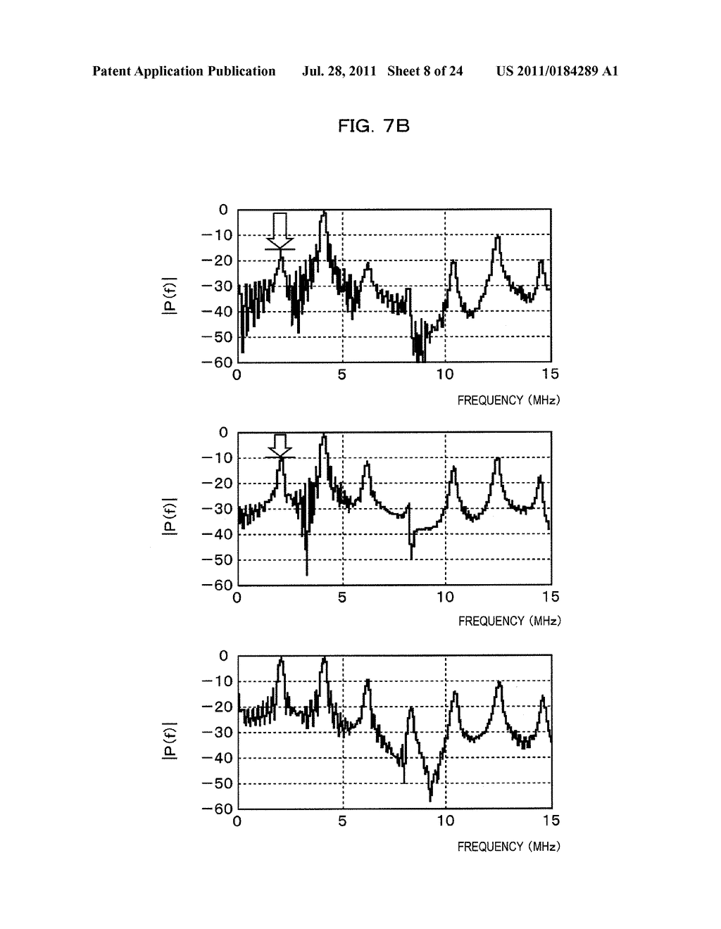 ULTRASONIC DIAGNOSTIC APPARATUS - diagram, schematic, and image 09