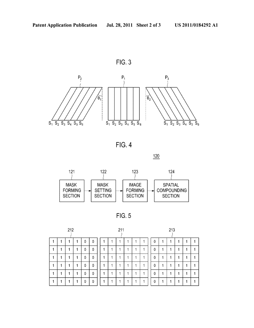 ULTRASOUND IMAGE ENHANCEMENT IN AN ULTRASOUND SYSTEM - diagram, schematic, and image 03