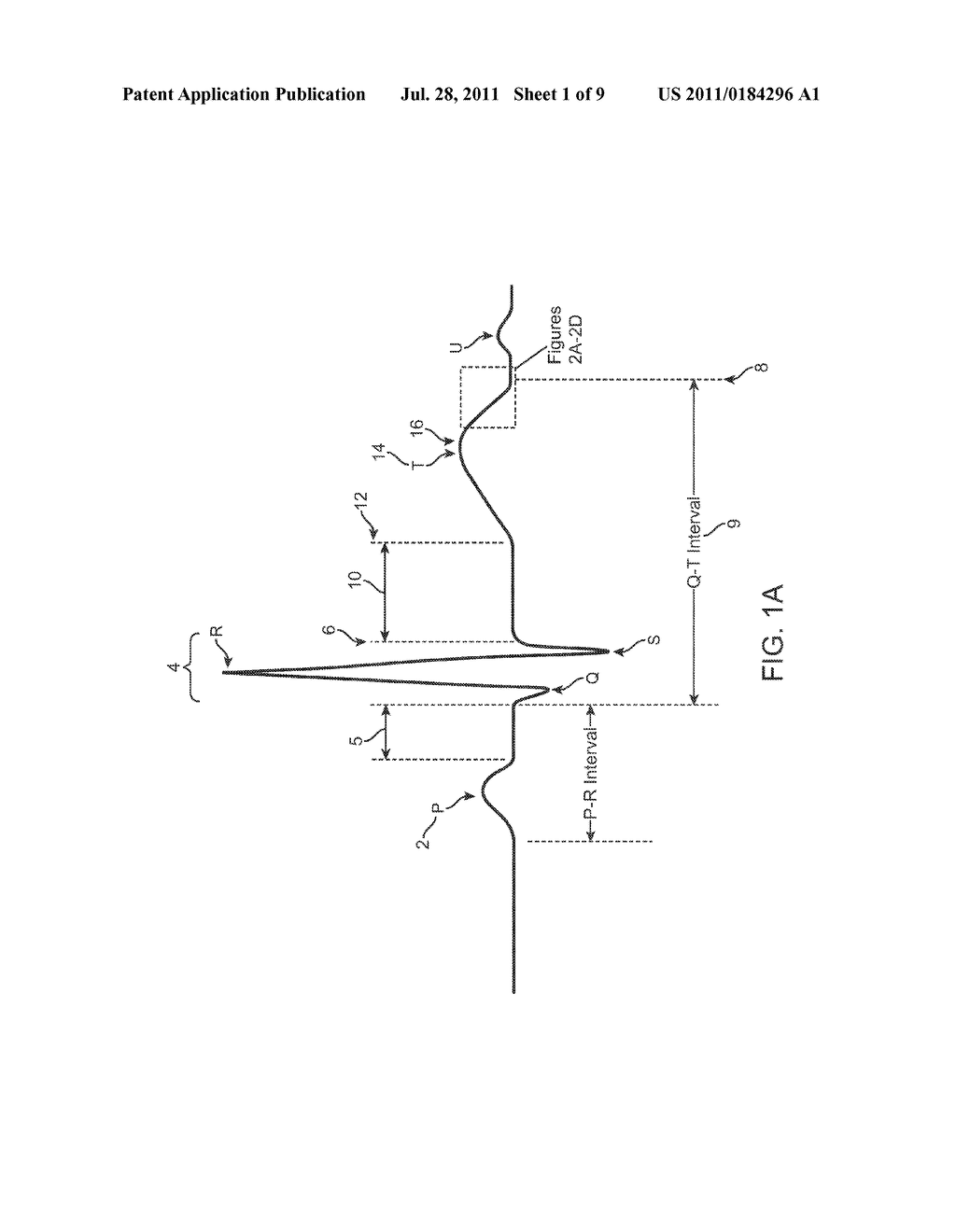 METHOD AND SYSTEM FOR QUANTITATIVE ASSESSMENT OF CARDIAC ELECTRICAL EVENTS - diagram, schematic, and image 02