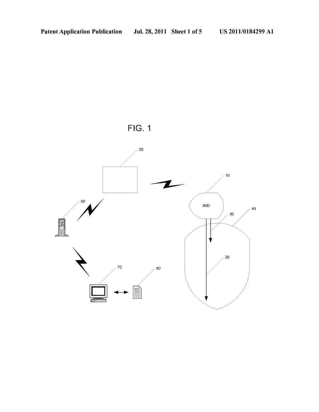 SYSTEM AND METHOD OF USING AV CONDUCTION TIMING - diagram, schematic, and image 02