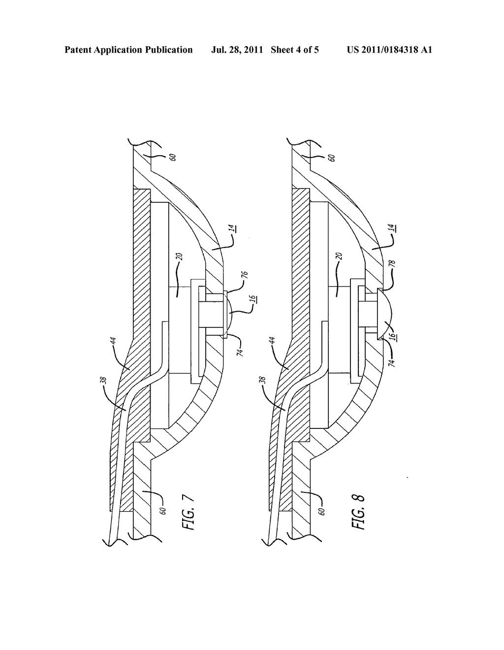 UTERINE CONTRACTION SENSING SYSTEM AND METHOD - diagram, schematic, and image 05