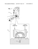 METHOD AND DEVICE FOR TREATMENT OF KELOIDS AND HYPERTROPHIC SCARS USING     FOCUSED ULTRASOUND diagram and image
