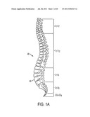ORTHOPEDIC APPARATUSES FOR MOBILIZING, STRETCHING AND PROTECTING THE     SPINAL COLUMN diagram and image