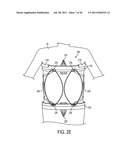 ORTHOPEDIC APPARATUSES FOR MOBILIZING, STRETCHING AND PROTECTING THE     SPINAL COLUMN diagram and image