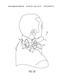 ORTHOPEDIC APPARATUSES FOR MOBILIZING, STRETCHING AND PROTECTING THE     SPINAL COLUMN diagram and image