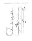 ERCP Catheter with a Removable Handle for Lithotriptor Compatible Basket diagram and image