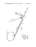 ERCP Catheter with a Removable Handle for Lithotriptor Compatible Basket diagram and image