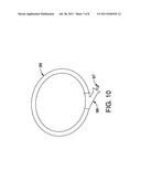 ERCP Catheter with a Removable Handle for Lithotriptor Compatible Basket diagram and image