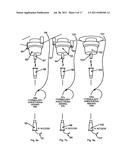 Sterile liquid materials distribution, consumption and material waste     disposal method and apparatus diagram and image