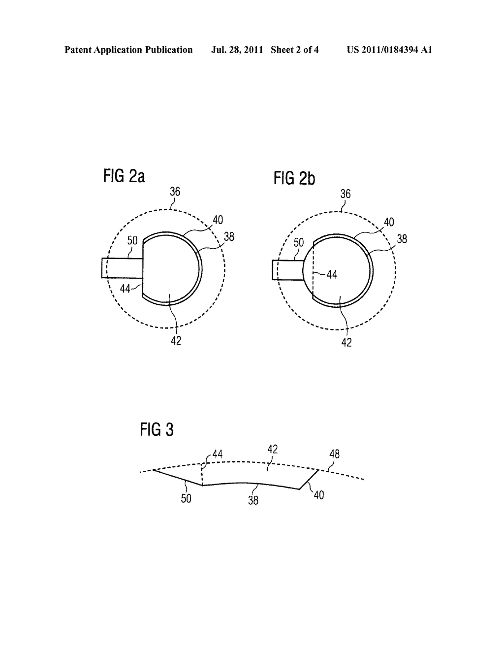 Apparatus for Cutting a Human Cornea - diagram, schematic, and image 03