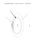 METHOD FOR LASER CAPSULOTOMY AND LENS CONDITIONING diagram and image