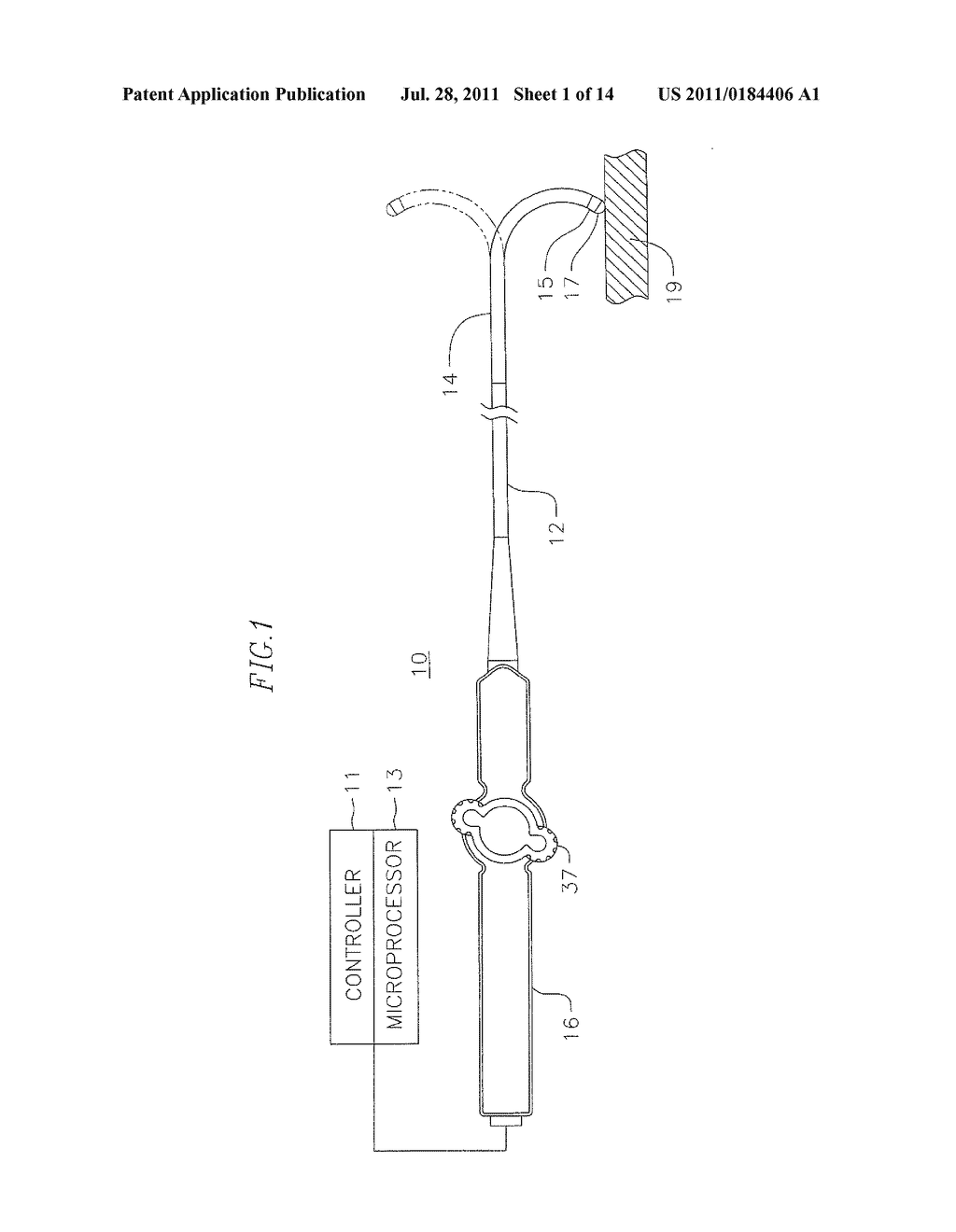 CATHETER HAVING A FORCE SENSING DISTAL TIP - diagram, schematic, and image 02