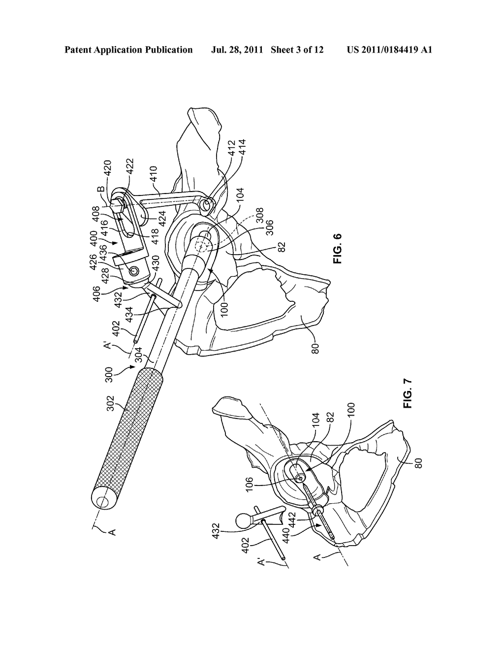 PATIENT-SPECIFIC ACETABULAR GUIDES AND ASSOCIATED INSTRUMENTS - diagram, schematic, and image 04