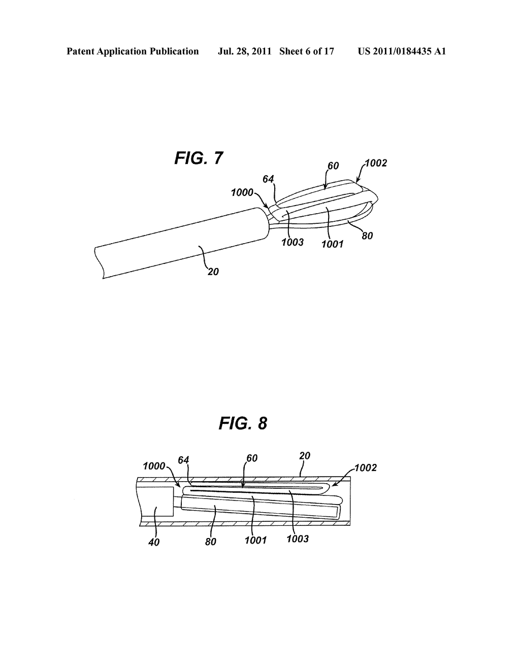 Method of Fitting Pouch in Tissue Retrieval Device - diagram, schematic, and image 07