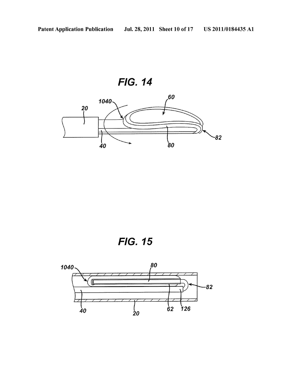 Method of Fitting Pouch in Tissue Retrieval Device - diagram, schematic, and image 11
