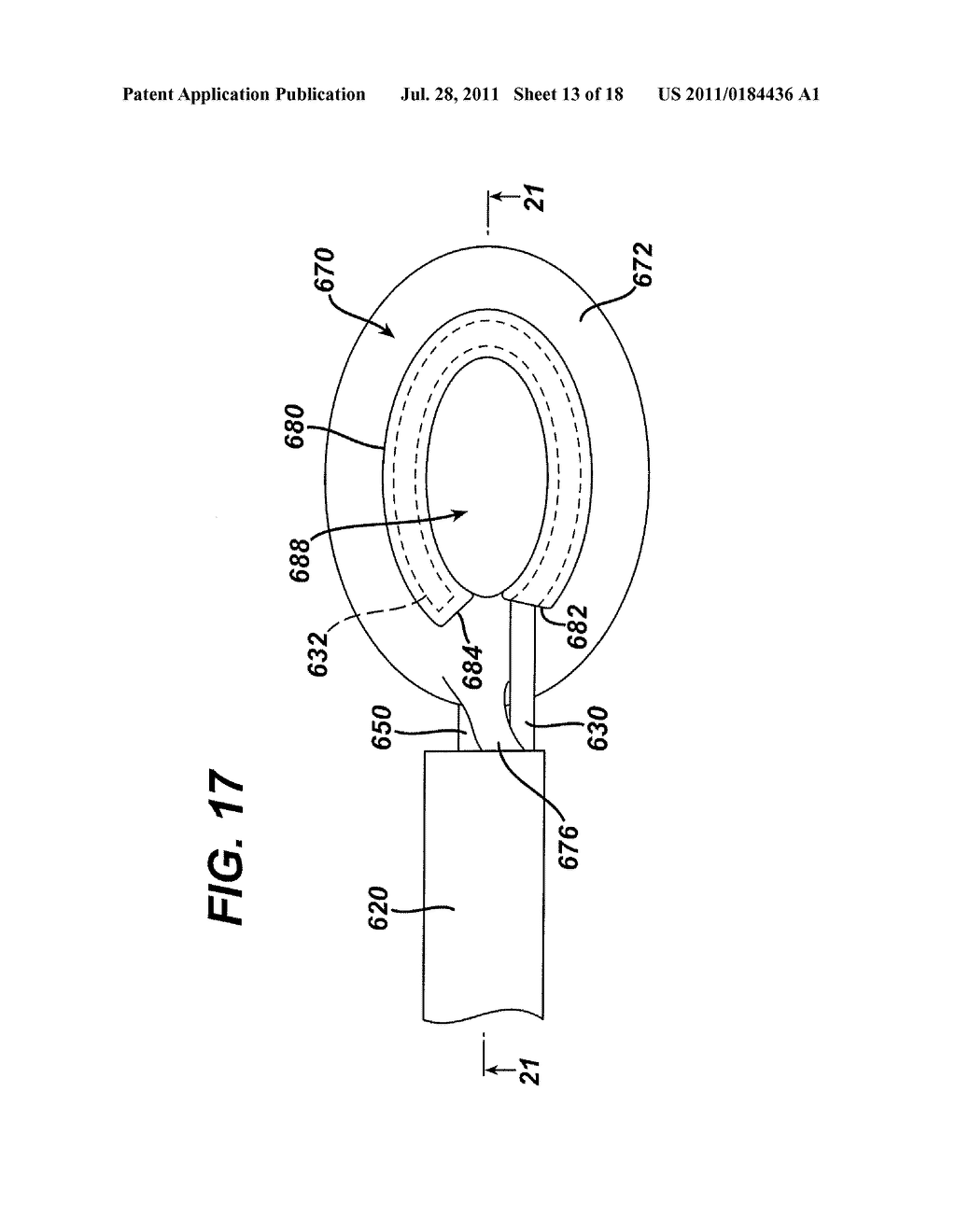 Tissue Retrieval Device with Reinforced Pouch and Variable Volume - diagram, schematic, and image 14