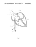 Biological Matrix for Cardiac Repair diagram and image