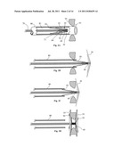 Biological Matrix for Cardiac Repair diagram and image