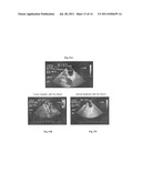 Biological Matrix for Cardiac Repair diagram and image