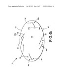 Prosthetic repair patch with integrated sutures and method therefor diagram and image