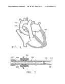 Apparatus and Methods for Anastomosis diagram and image