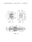 Apparatus and Methods for Anastomosis diagram and image