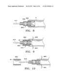 Apparatus and Methods for Anastomosis diagram and image